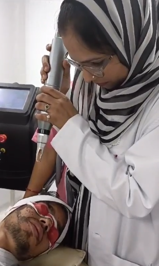 Laser treatment session at the clinic