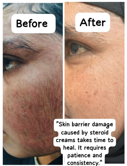Example of skin concern photography